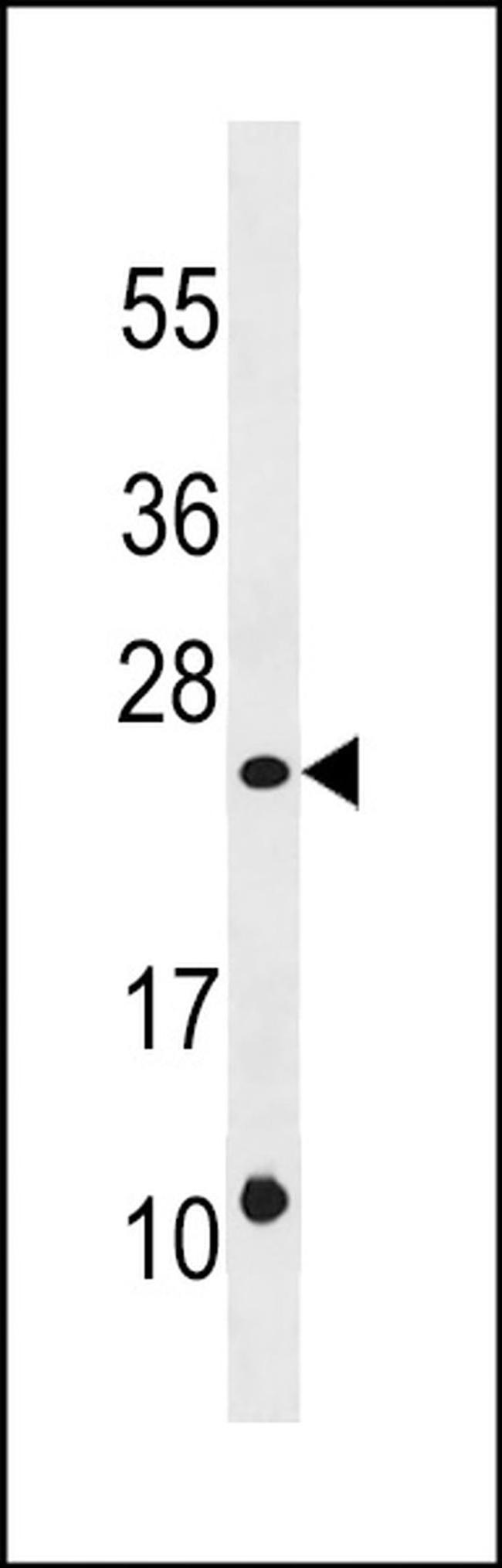 DUSP13 Antibody in Western Blot (WB)