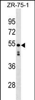 KRT87P Antibody in Western Blot (WB)