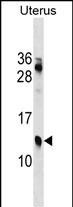 KLKP1 Antibody in Western Blot (WB)