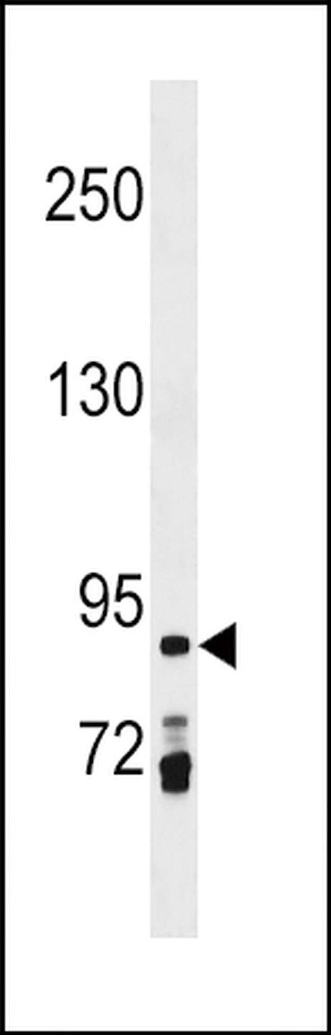 PRICKLE1 Antibody in Western Blot (WB)