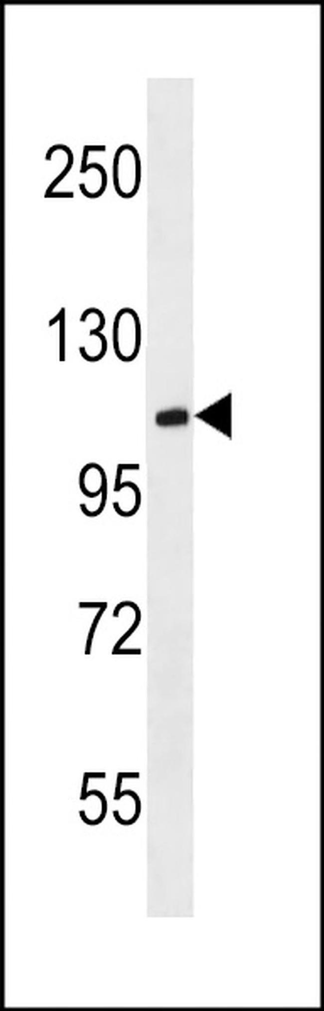 MBD6 Antibody in Western Blot (WB)