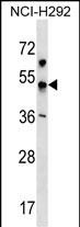 KCNJ18 Antibody in Western Blot (WB)