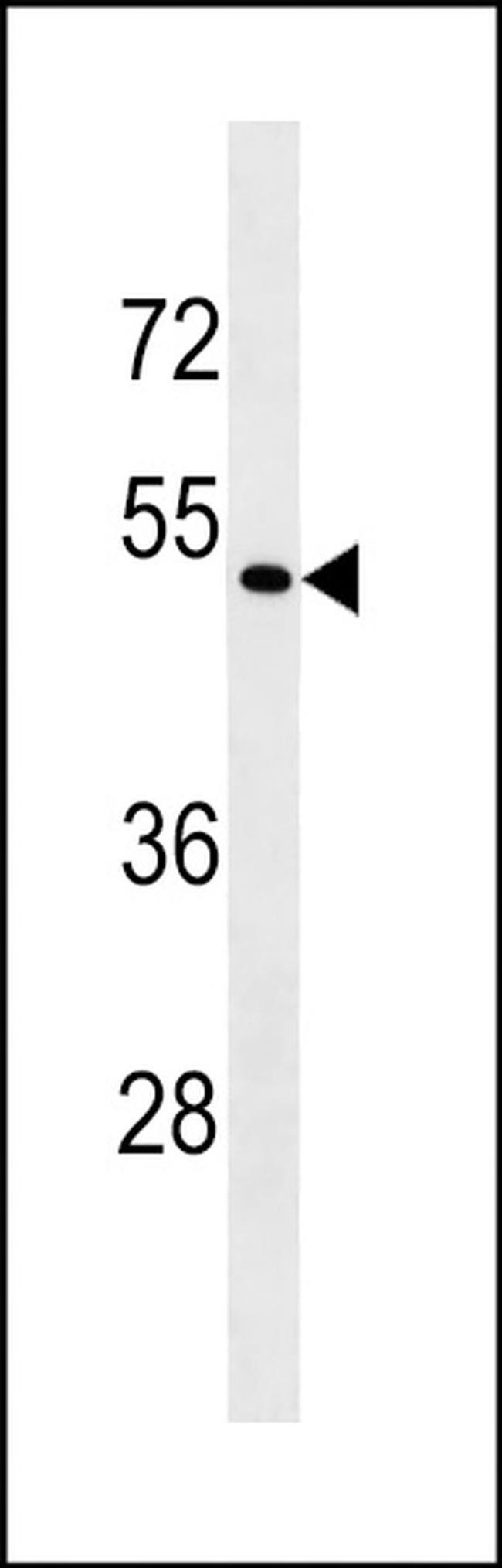 eIF2 gamma Antibody in Western Blot (WB)