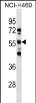 RBMY1D Antibody in Western Blot (WB)
