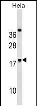 RNF224 Antibody in Western Blot (WB)