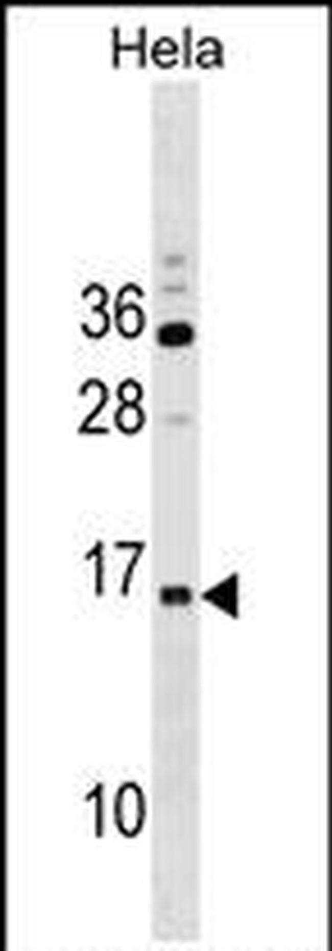 RPP14 Antibody in Western Blot (WB)