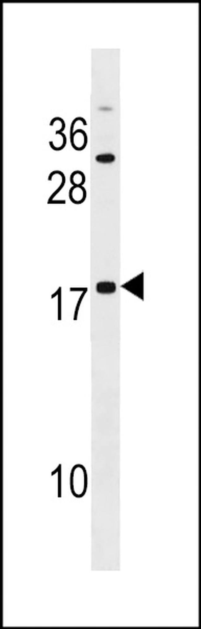 SPANXC Antibody in Western Blot (WB)