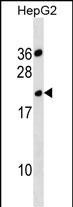 TMPRSS11BNL Antibody in Western Blot (WB)