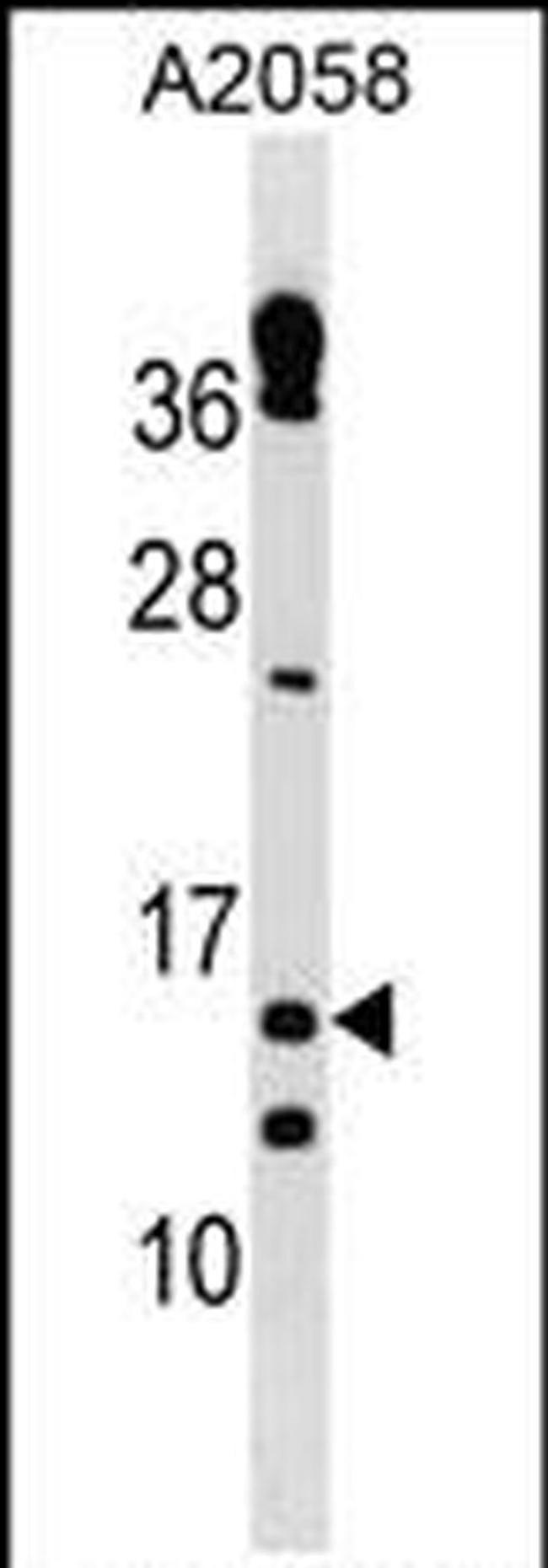 TXNRD3NB Antibody in Western Blot (WB)