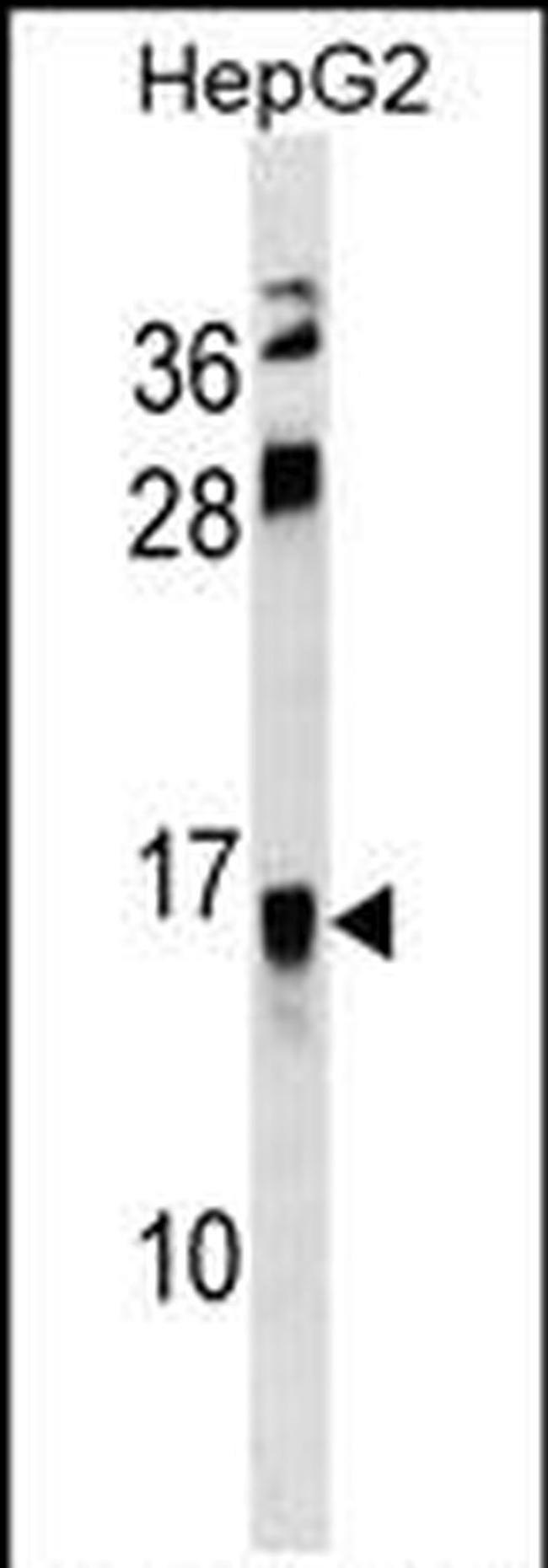 RELM beta Antibody in Western Blot (WB)