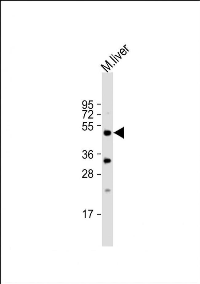 STK38 Antibody in Western Blot (WB)