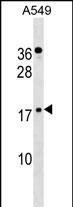 ZNF663P Antibody in Western Blot (WB)