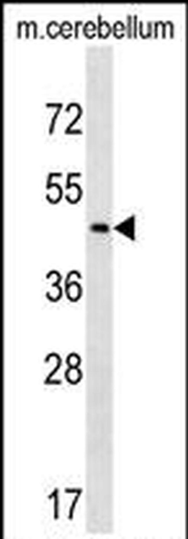 CHST2 Antibody in Western Blot (WB)