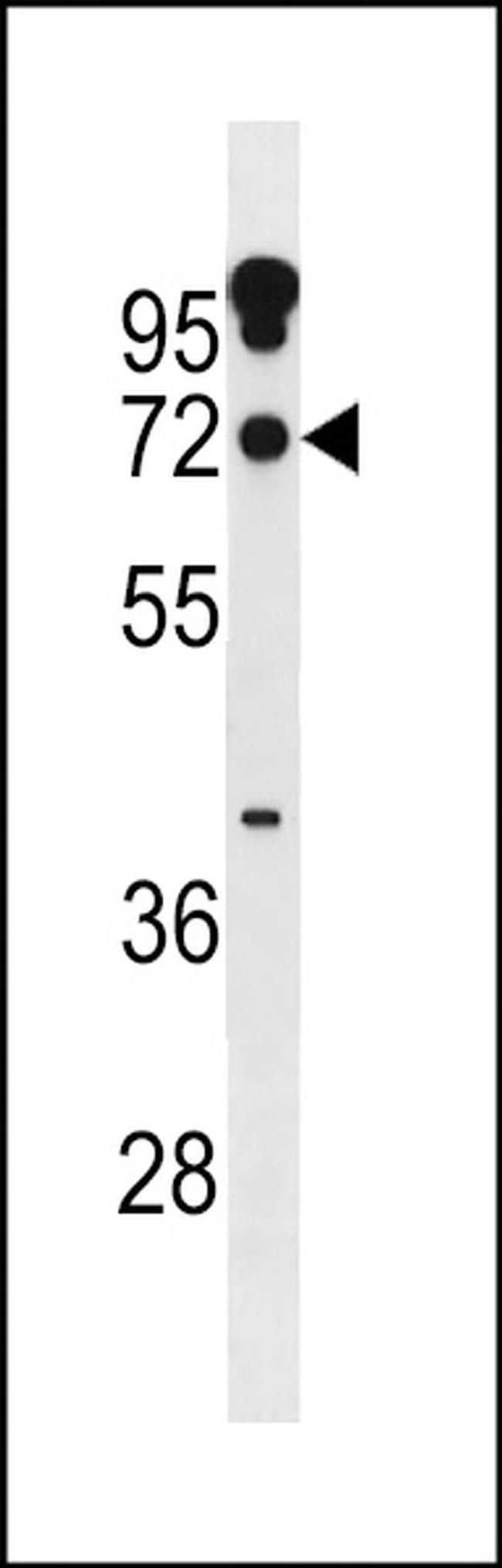 ZNF805 Antibody in Western Blot (WB)