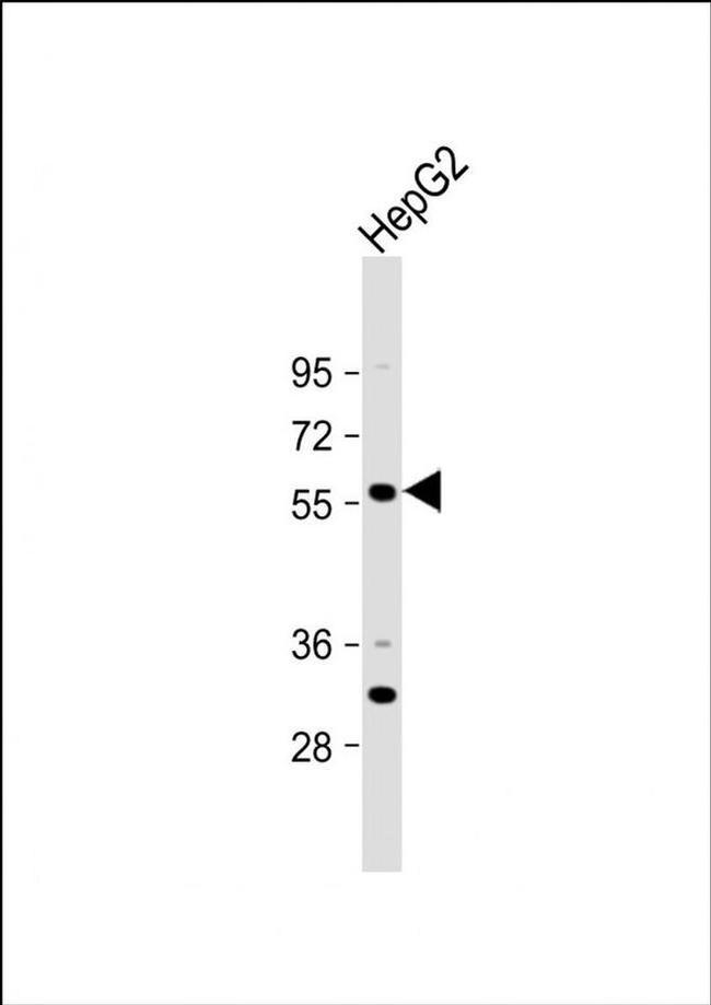 ST6GAL2 Antibody in Western Blot (WB)
