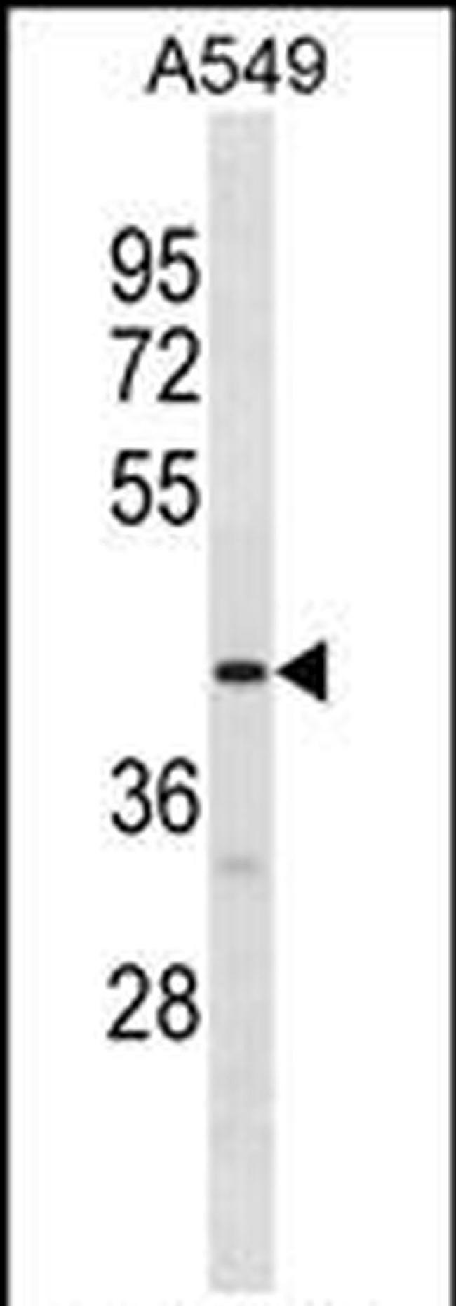 GPR52 Antibody in Western Blot (WB)