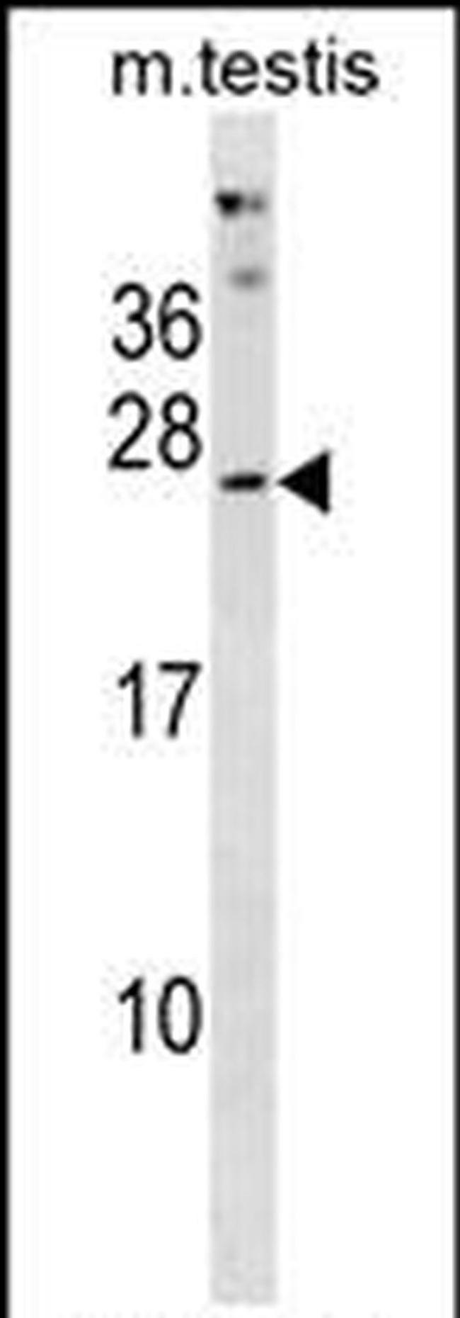 PHOSPHO2 Antibody in Western Blot (WB)