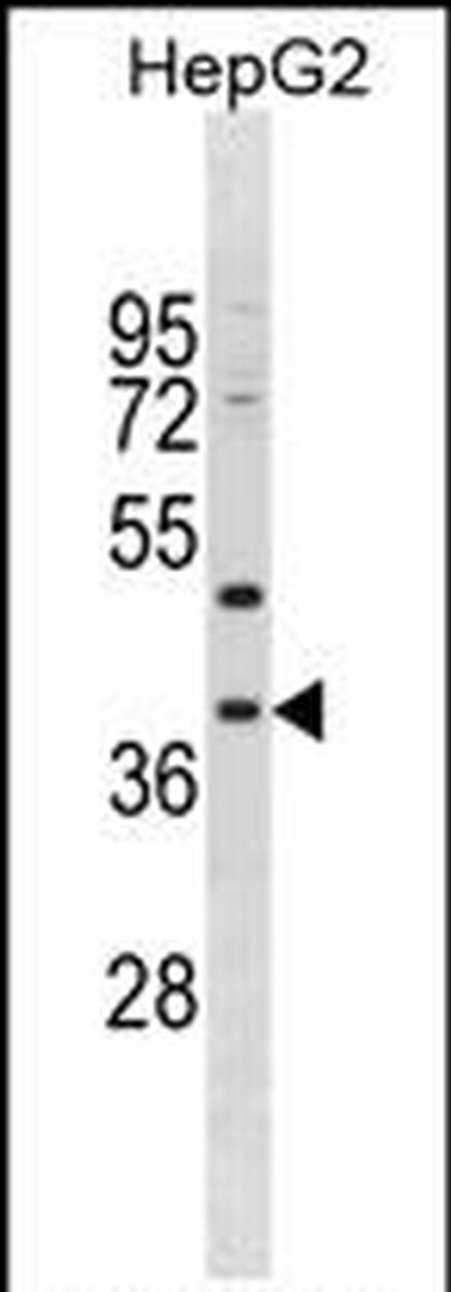 MPPED1 Antibody in Western Blot (WB)