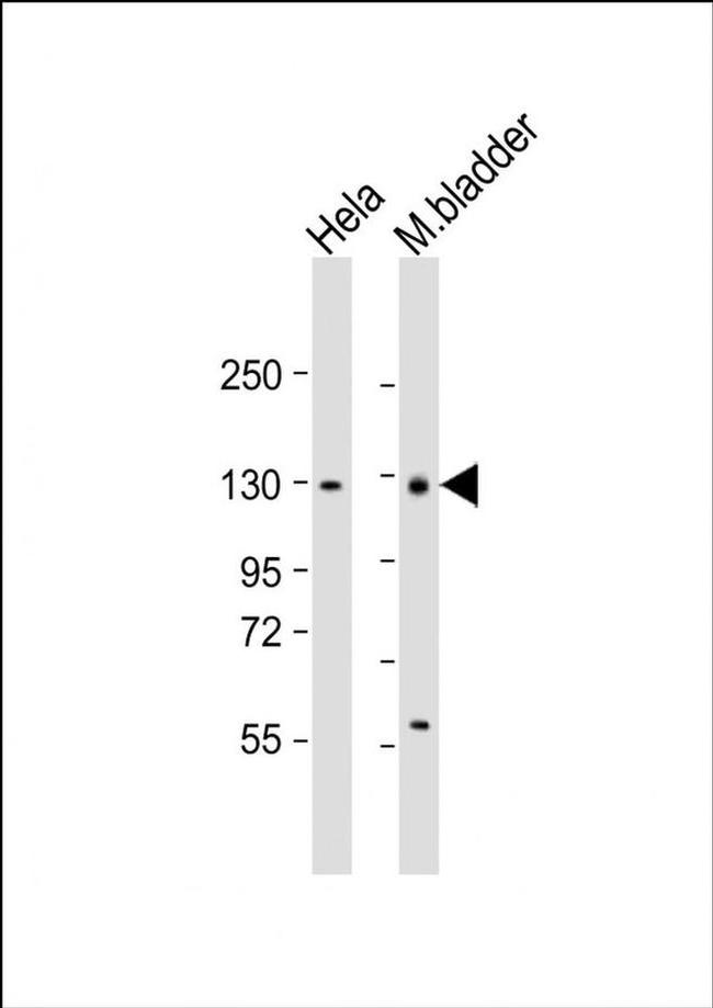 ENPP1 Antibody in Western Blot (WB)