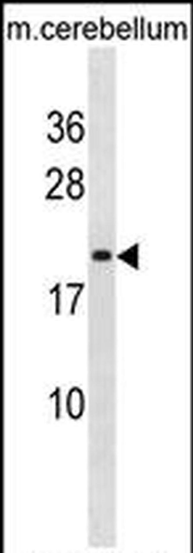 LIN7B Antibody in Western Blot (WB)