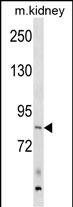 ARHGEF16 Antibody in Western Blot (WB)