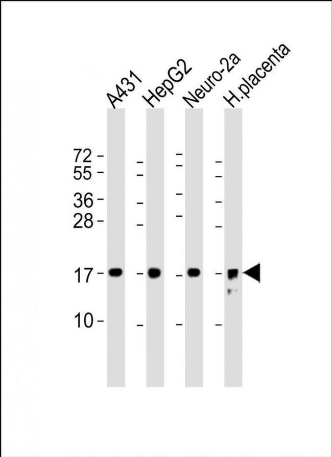 RPL22 Antibody in Western Blot (WB)