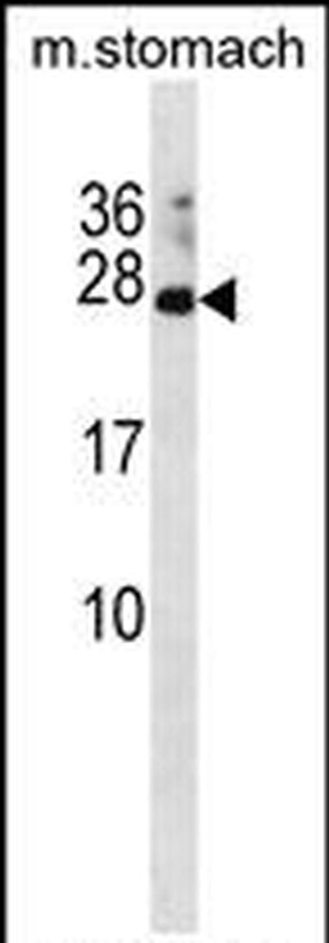 RAP2C Antibody in Western Blot (WB)