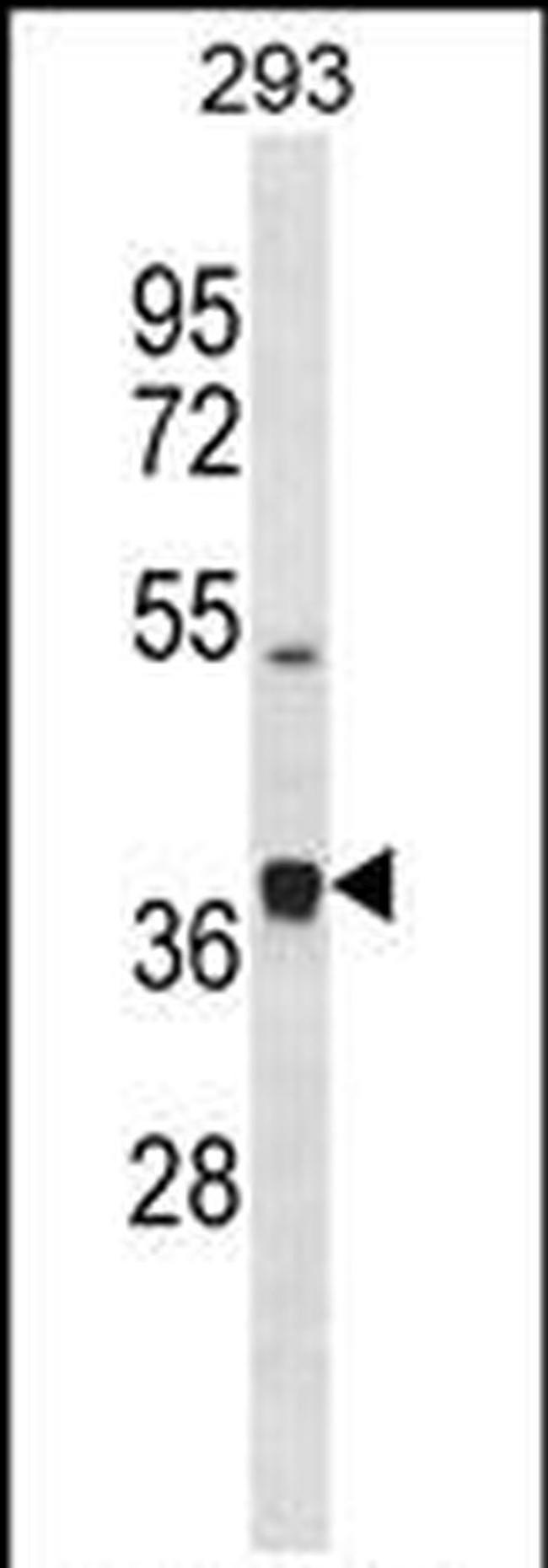 PCOLCE2 Antibody in Western Blot (WB)