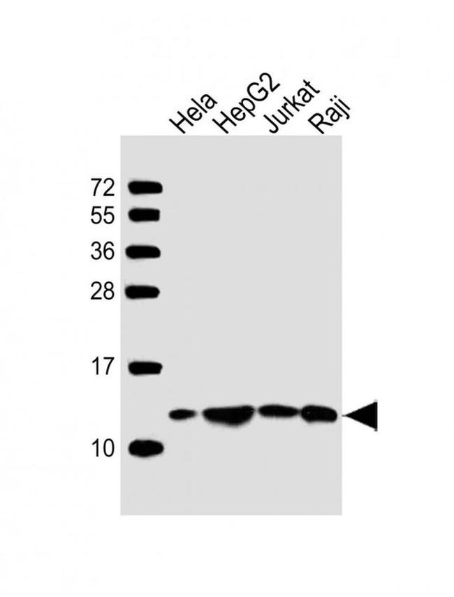 HSPE1 Antibody in Western Blot (WB)