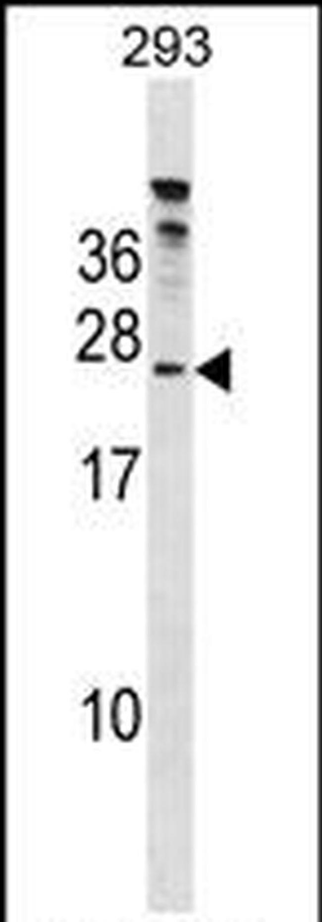 HTATSF1 Antibody in Western Blot (WB)