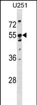 KRT86 Antibody in Western Blot (WB)
