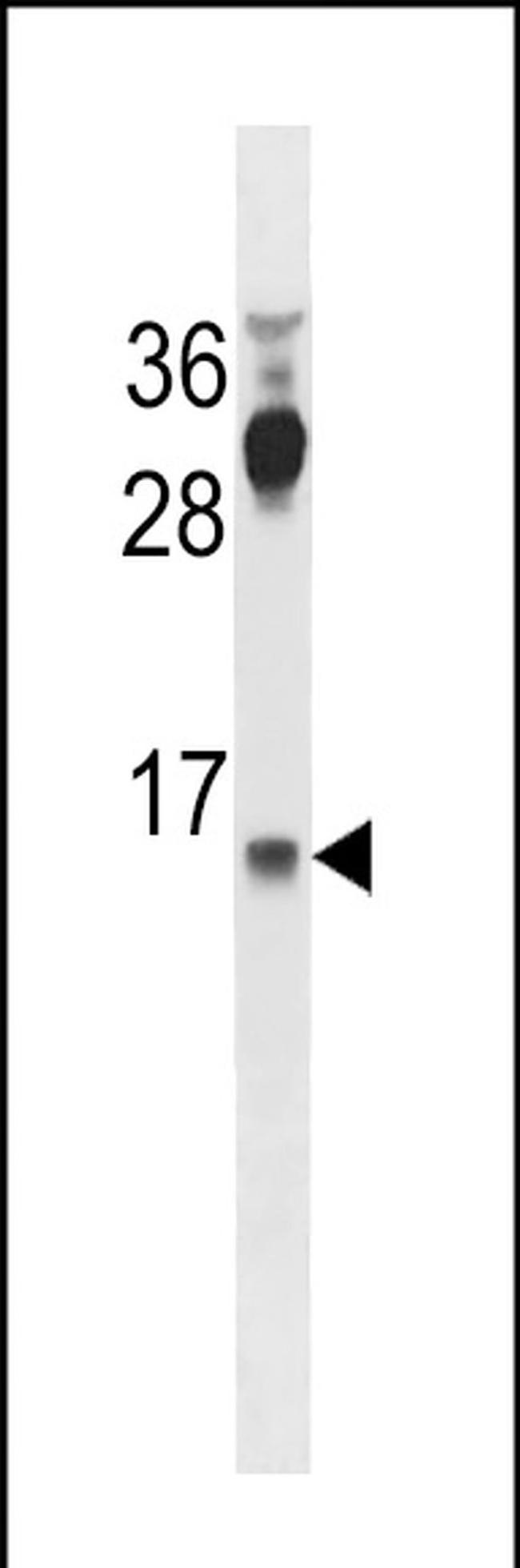 CYYR1 Antibody in Western Blot (WB)