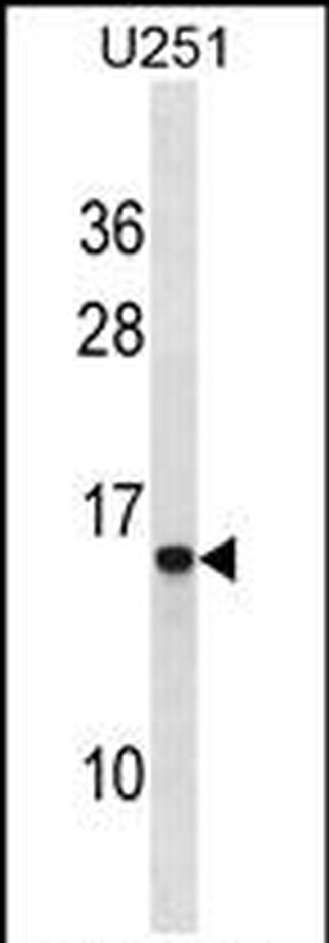HPa1 Antibody in Western Blot (WB)