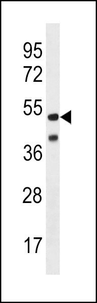 HHV14 UL38 Antibody in Western Blot (WB)