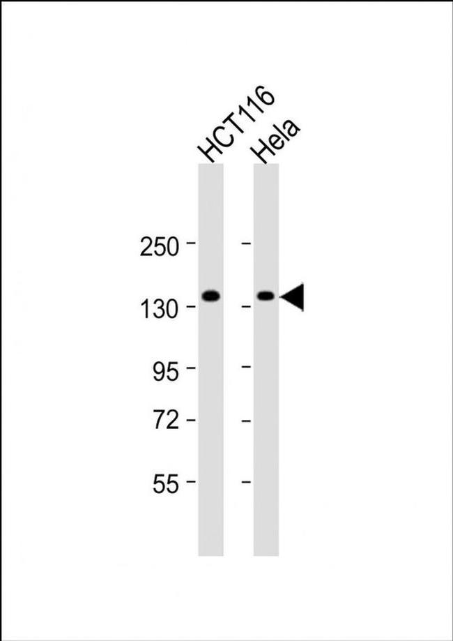 ANKS1 Antibody in Western Blot (WB)