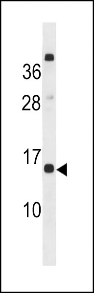 CLEC19A Antibody in Western Blot (WB)