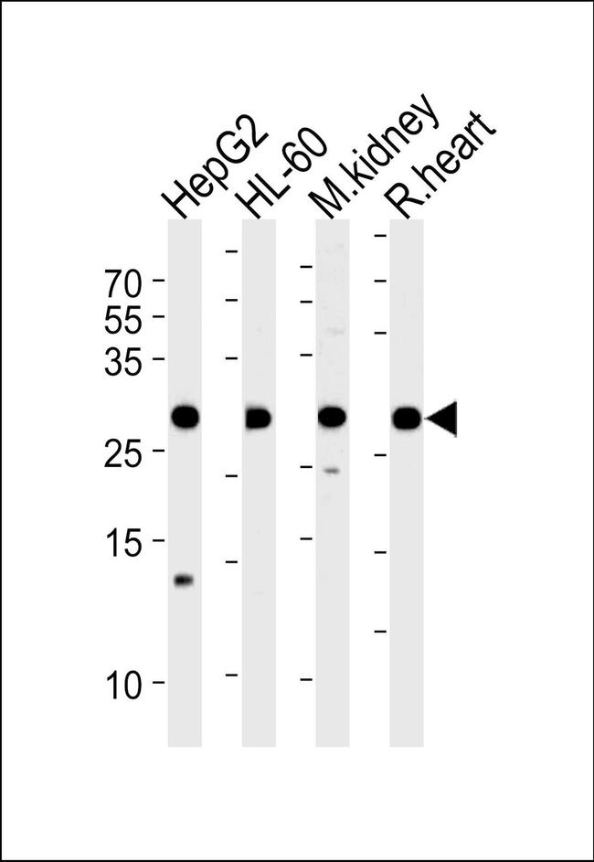 ATP Synthase B1 Antibody in Western Blot (WB)
