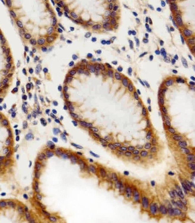 CHML Antibody in Immunohistochemistry (IHC)