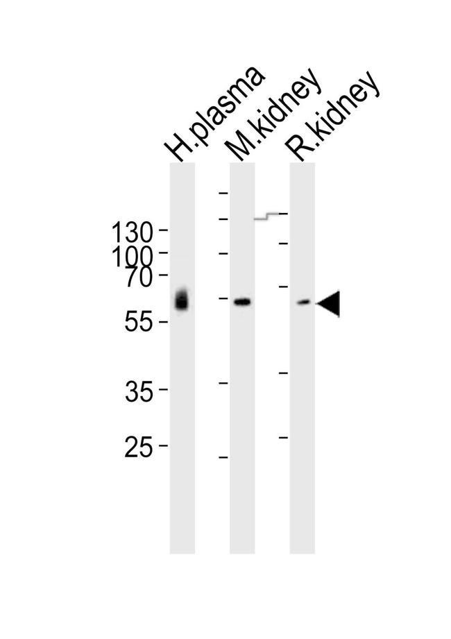 CNDP1 Antibody in Western Blot (WB)