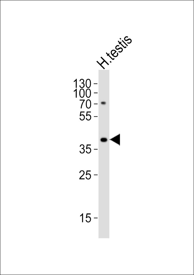 TSPY2 Antibody in Western Blot (WB)