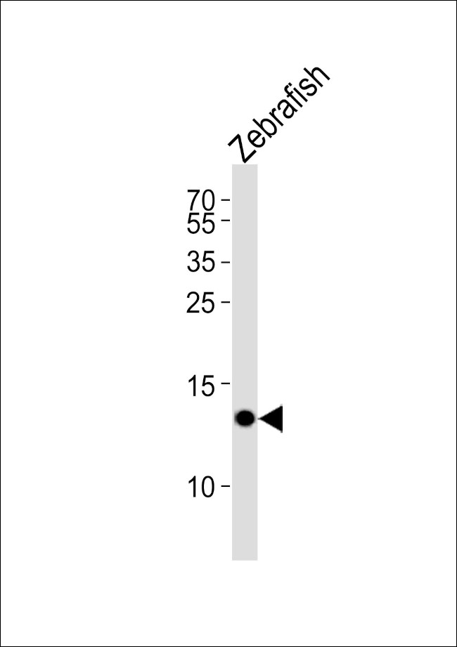 FABP10A Antibody in Western Blot (WB)