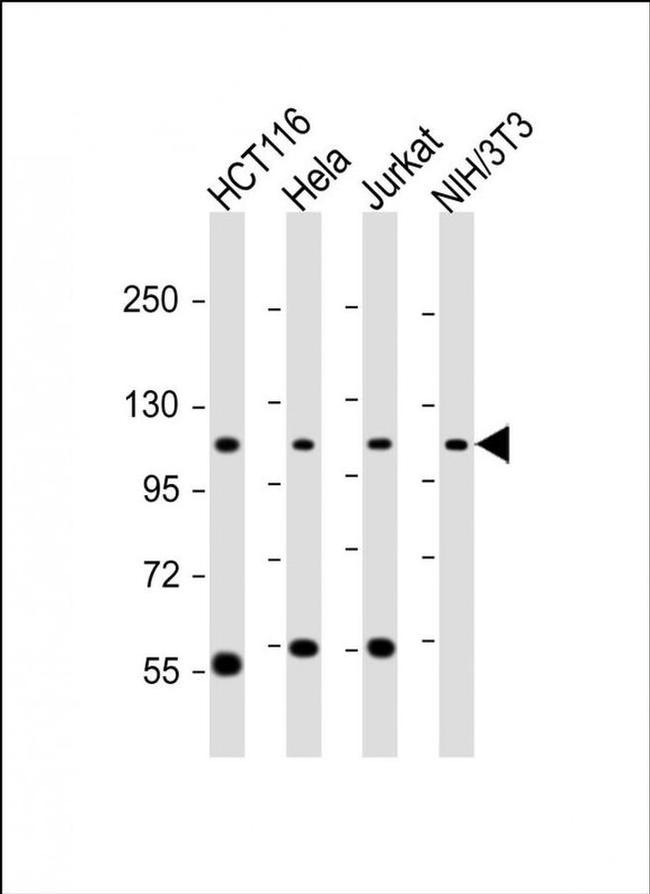 PRP6 Antibody in Western Blot (WB)