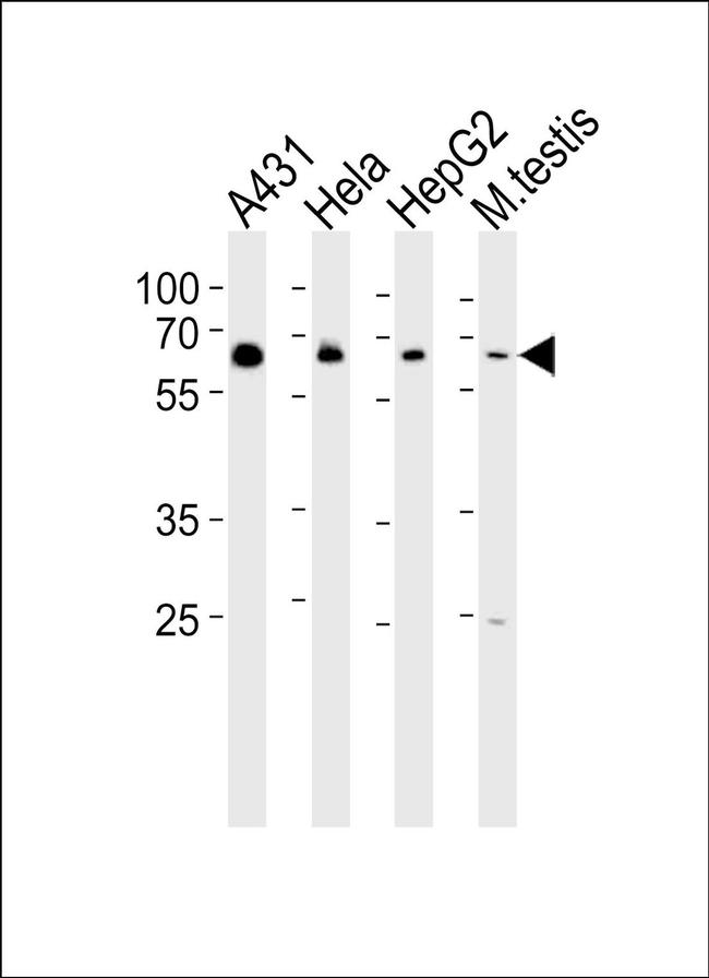 EHD4 Antibody in Western Blot (WB)