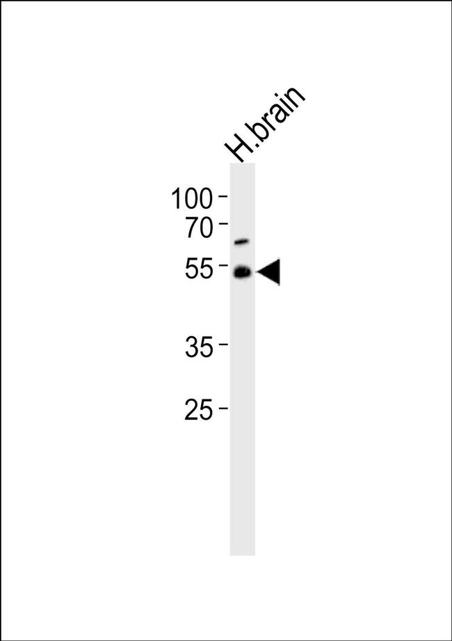 TRIM43B Antibody in Western Blot (WB)
