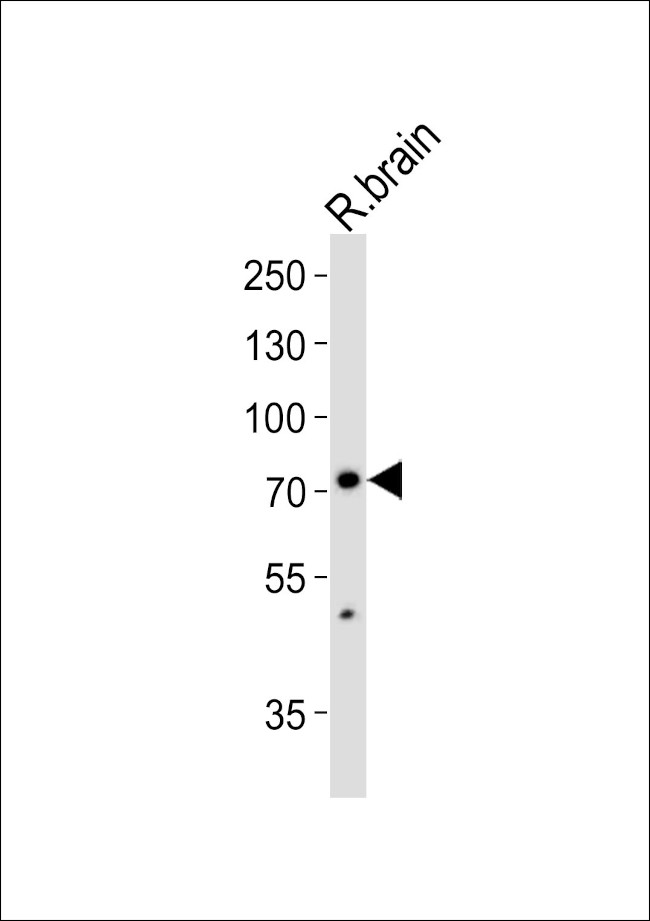 SV2C Antibody in Western Blot (WB)