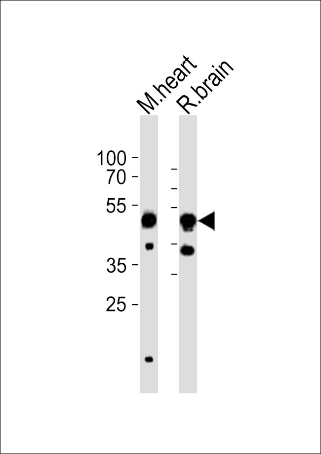 CHRNB3 Antibody in Western Blot (WB)