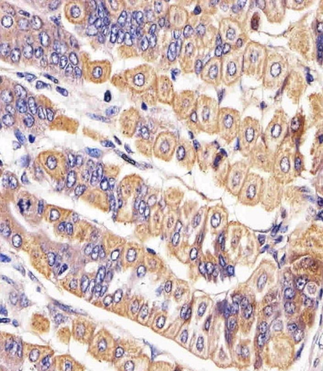 ROR2 Antibody in Immunohistochemistry (IHC)