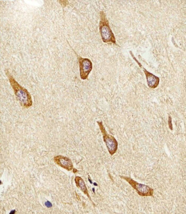 LIS1 Antibody in Immunohistochemistry (IHC)
