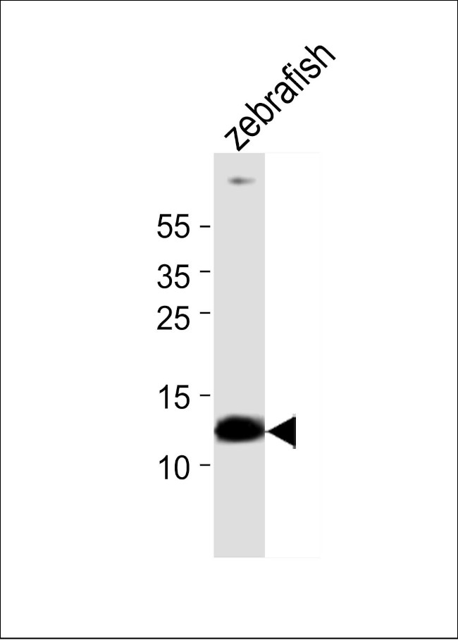 BA1 Antibody in Western Blot (WB)