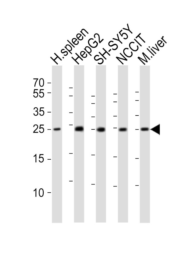 MIXL1 Antibody in Western Blot (WB)